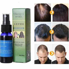 Organic Hair Growth Essence - World's Finest - 