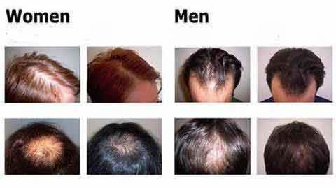 Organic Hair Growth Essence - World's Finest - 